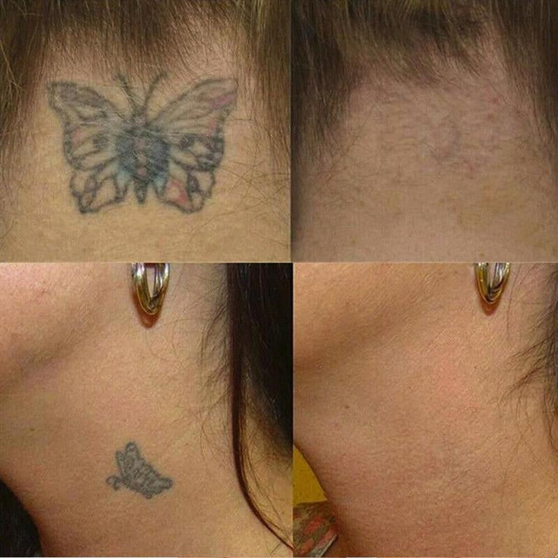 10ml Tattoo Correction Liquid with Plant Extracts