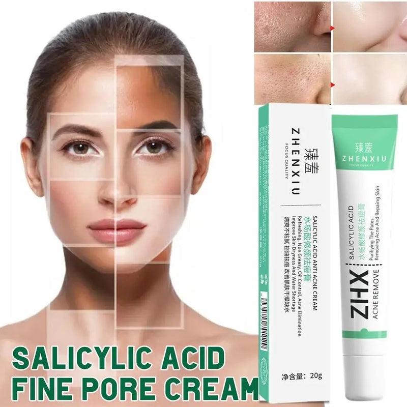 20g Salicylic Acid Acne Removal Cream for Clear Skin