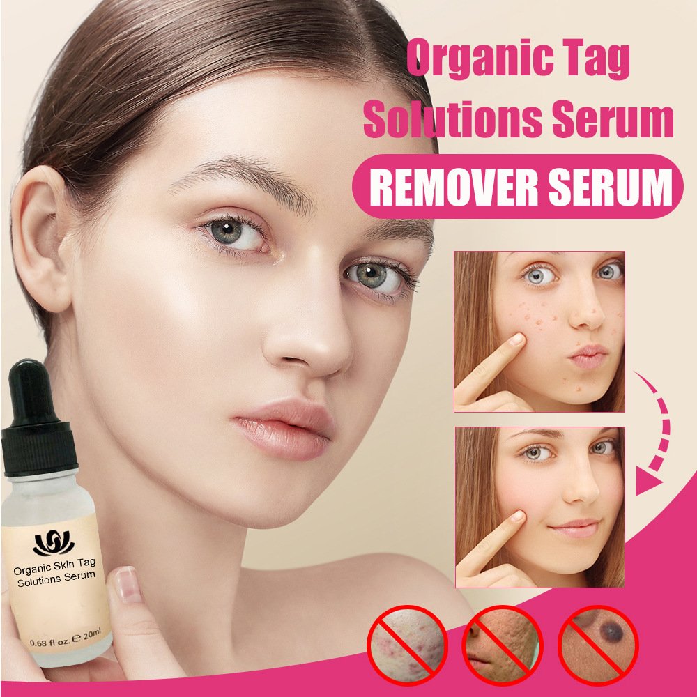 All-Natural Skin Tag and Mole Removal Serum, Herbal Formula