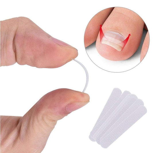 10pcs Ingrown Toenail Correction Clips