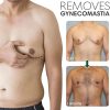 Gynecomastia Tightening Ginger Cream, Ginger Cream for Men, Effectively Shrinks Men Chest Tightening Ginger Cream