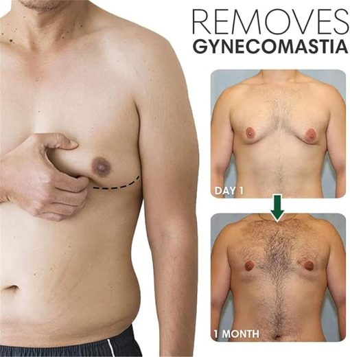 Gynecomastia Tightening Ginger Cream, Ginger Cream for Men, Effectively Shrinks Men Chest Tightening Ginger Cream