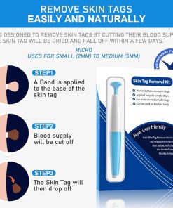 Skin Tag Removal Kit