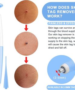 Skin Tag Removal Kit