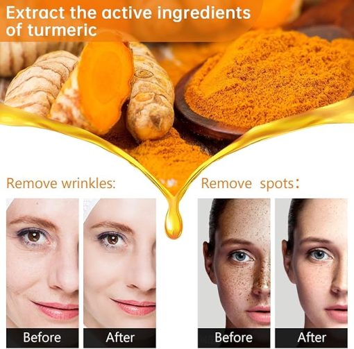 Turmeric Dark Spot Corrector Serum