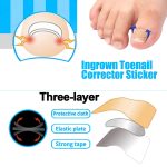 Ingrown Toenail Corrector Patches