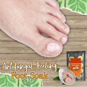 Anti-fungal Peeling Foot Soak